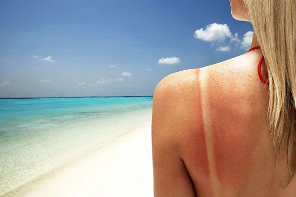Hai esagerato con il sole? Al rientro delle vacanze la pelle ha bisogno di cure intensive che riparino i danni causati dai raggi UV, ecco quali!