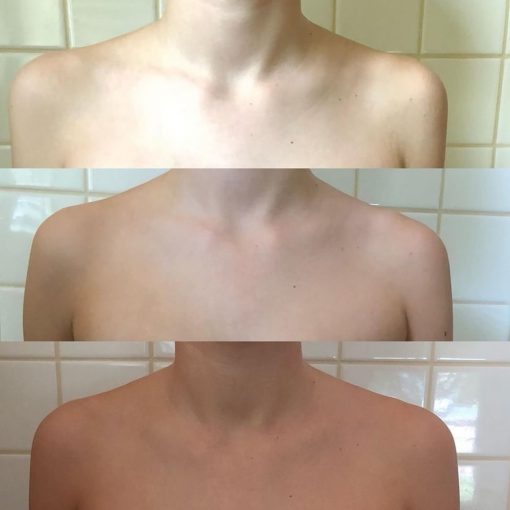 Winter Skin 3
